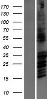 NMDAR2B (GRIN2B) Human Over-expression Lysate