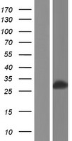 GSTM3 Human Over-expression Lysate