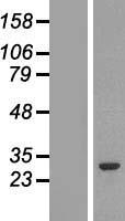 GSTM2 Human Over-expression Lysate