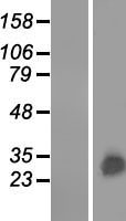 GSTA3 Human Over-expression Lysate