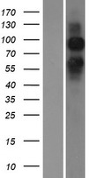 Metabotropic Glutamate Receptor 6 (GRM6) Human Over-expression Lysate