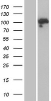 Mineralocorticoid Receptor (NR3C2) Human Over-expression Lysate