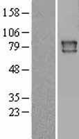 Cytochrome P450 Reductase (POR) Human Over-expression Lysate