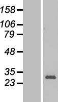 RPL13 Human Over-expression Lysate