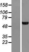 UGP2 Human Over-expression Lysate