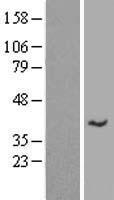 SLC35E4 Human Over-expression Lysate