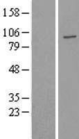 USP16 Human Over-expression Lysate