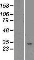 STX19 Human Over-expression Lysate
