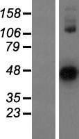 ASTL Human Over-expression Lysate