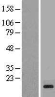 PRY (PRY2) Human Over-expression Lysate