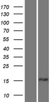 TPD52L1 Human Over-expression Lysate