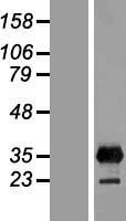 LIN28B Human Over-expression Lysate
