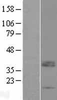 LRRC52 Human Over-expression Lysate