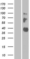 LRRC55 Human Over-expression Lysate