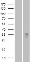 OR1B1 Human Over-expression Lysate
