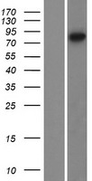 TRIM67 Human Over-expression Lysate