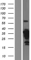 ZWINT Human Over-expression Lysate