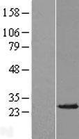 AK3L1 (AK4) Human Over-expression Lysate