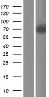 Semaphorin 3B (SEMA3B) Human Over-expression Lysate