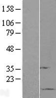 Sumo 1 (SUMO1) Human Over-expression Lysate