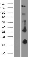 EDA Human Over-expression Lysate
