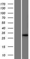 SHISA2 Human Over-expression Lysate