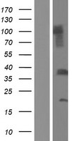 C1QTNF9B Human Over-expression Lysate