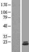 Dysferlin interacting protein 1 (PPP1R27) Human Over-expression Lysate