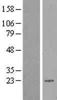 ERCC8 Human Over-expression Lysate