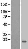 TTC32 Human Over-expression Lysate