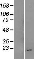 ZNF407-AS1 Human Over-expression Lysate