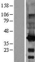 GALE Human Over-expression Lysate