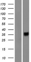 CD200R1L Human Over-expression Lysate