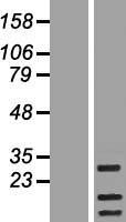 RAB19B (RAB19) Human Over-expression Lysate