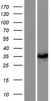SULT1C3 Human Over-expression Lysate