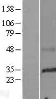 SMIM29 Human Over-expression Lysate