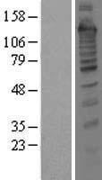 Treacher Collins syndrome protein (TCOF1) Human Over-expression Lysate