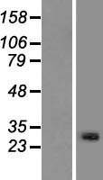 METTL21C Human Over-expression Lysate