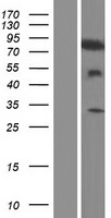 TIAM2 Human Over-expression Lysate