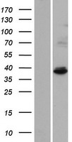 C1orf69 (IBA57) Human Over-expression Lysate