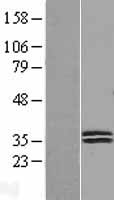 Deoxyribonuclease I like 1 (DNASE1L1) Human Over-expression Lysate