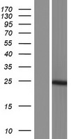 AK6 Human Over-expression Lysate