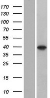 C8orf58 Human Over-expression Lysate