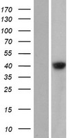 GDPGP1 Human Over-expression Lysate