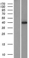PRR25 Human Over-expression Lysate