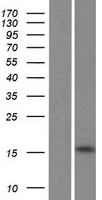 UBE2NL Human Over-expression Lysate