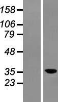 C6ORF154 (LRRC73) Human Over-expression Lysate