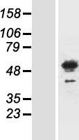 Meis homeobox 3 (MEIS3) Human Over-expression Lysate