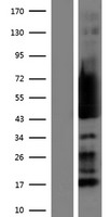 RPS5 Human Over-expression Lysate