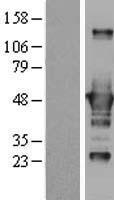 CTBP1 Human Over-expression Lysate